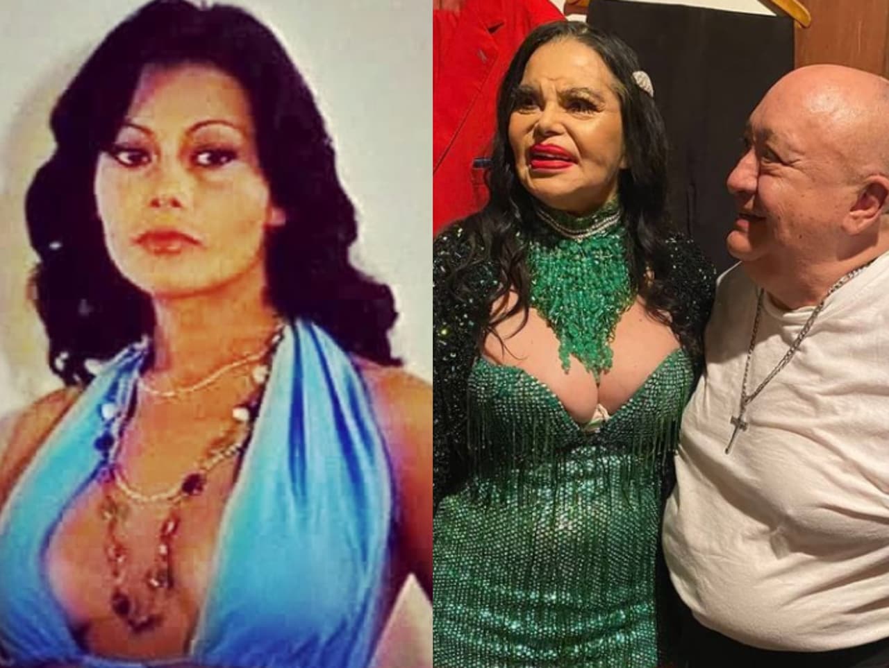 Rossy Mendoza, la legendaria actriz, es internada de urgencia