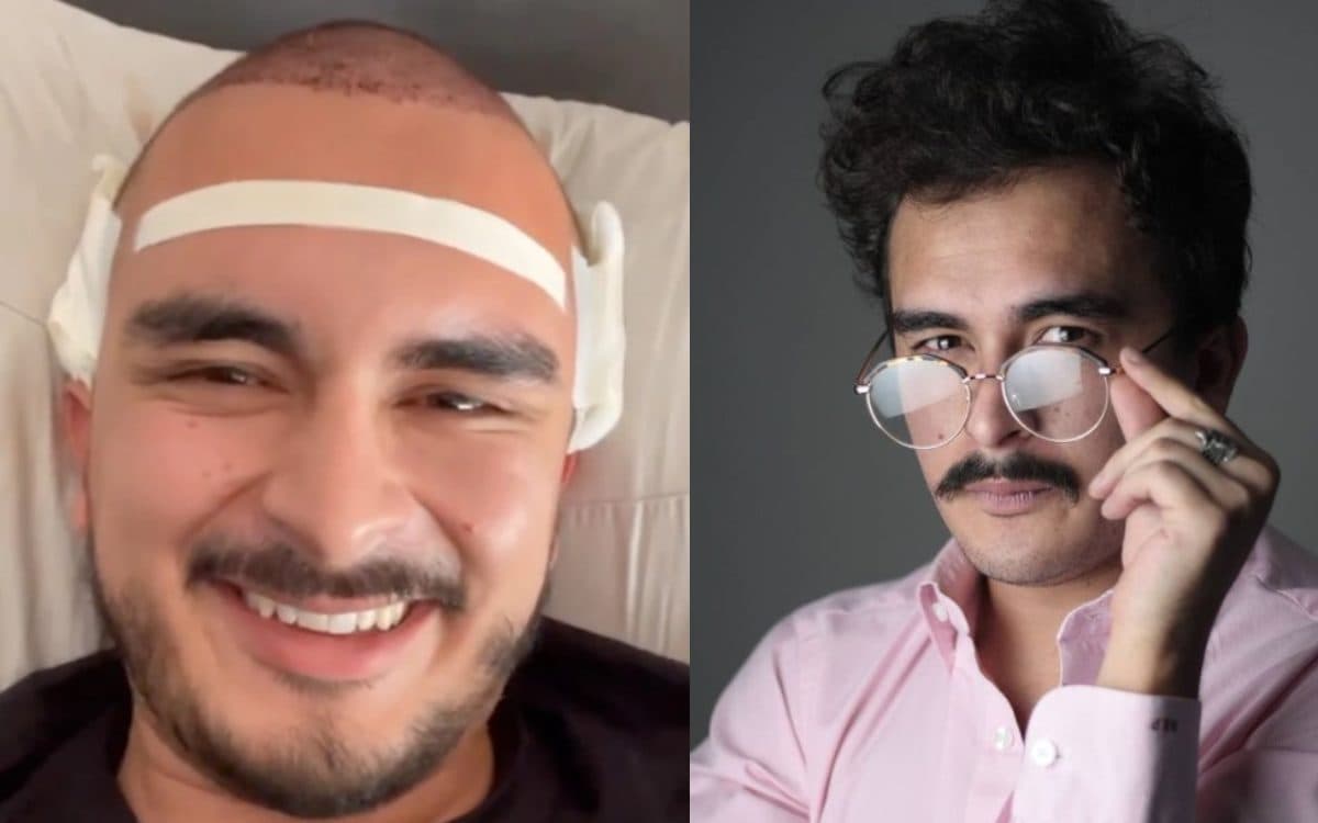 Ahora, le van a tomar el pelo