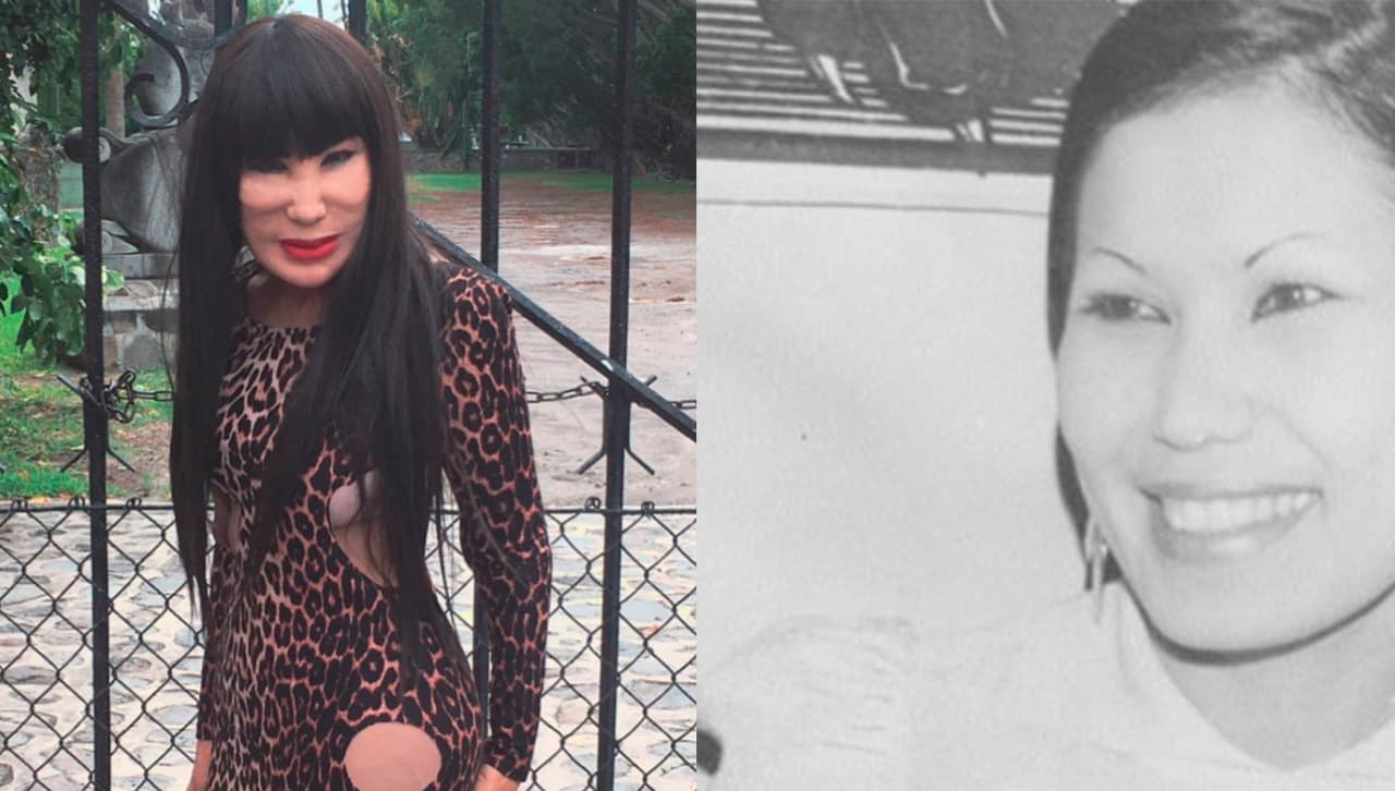 Lin May antes y despues de cirugias de rostro