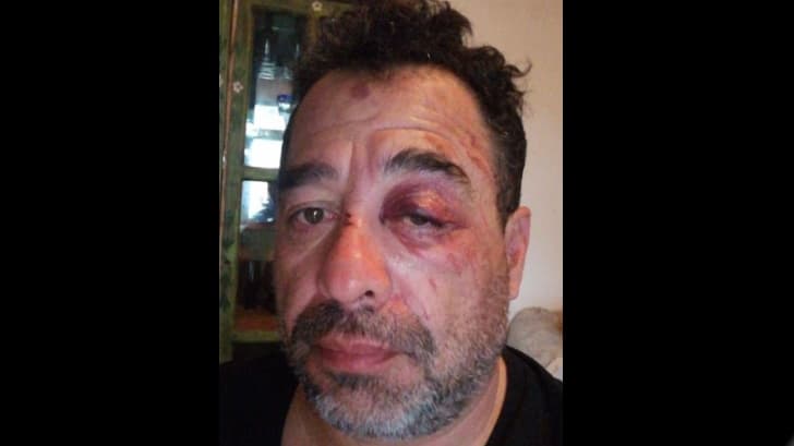 El Borrego compartió la foto de su accidente