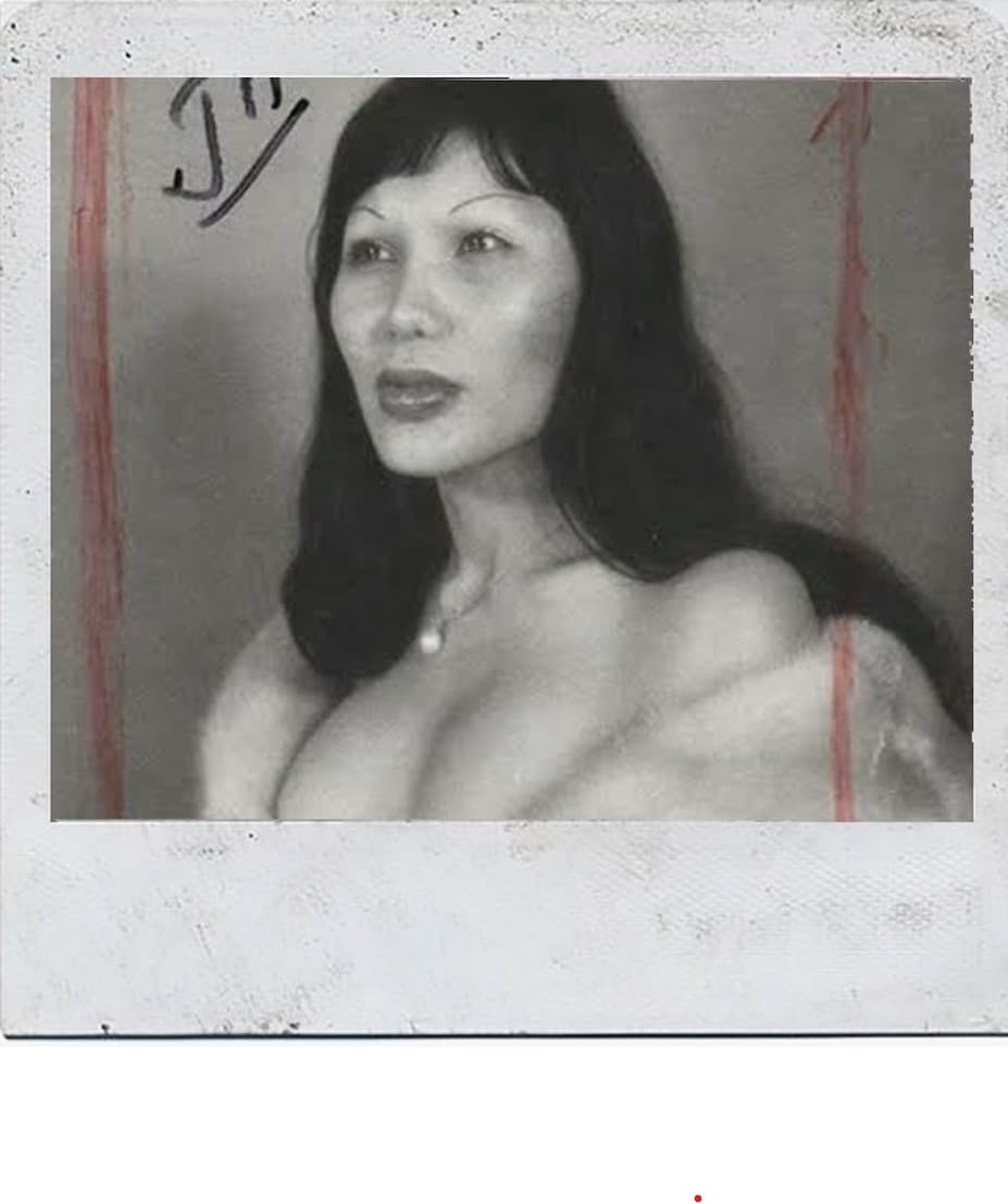 lyn-may-antes-de-cirugias2