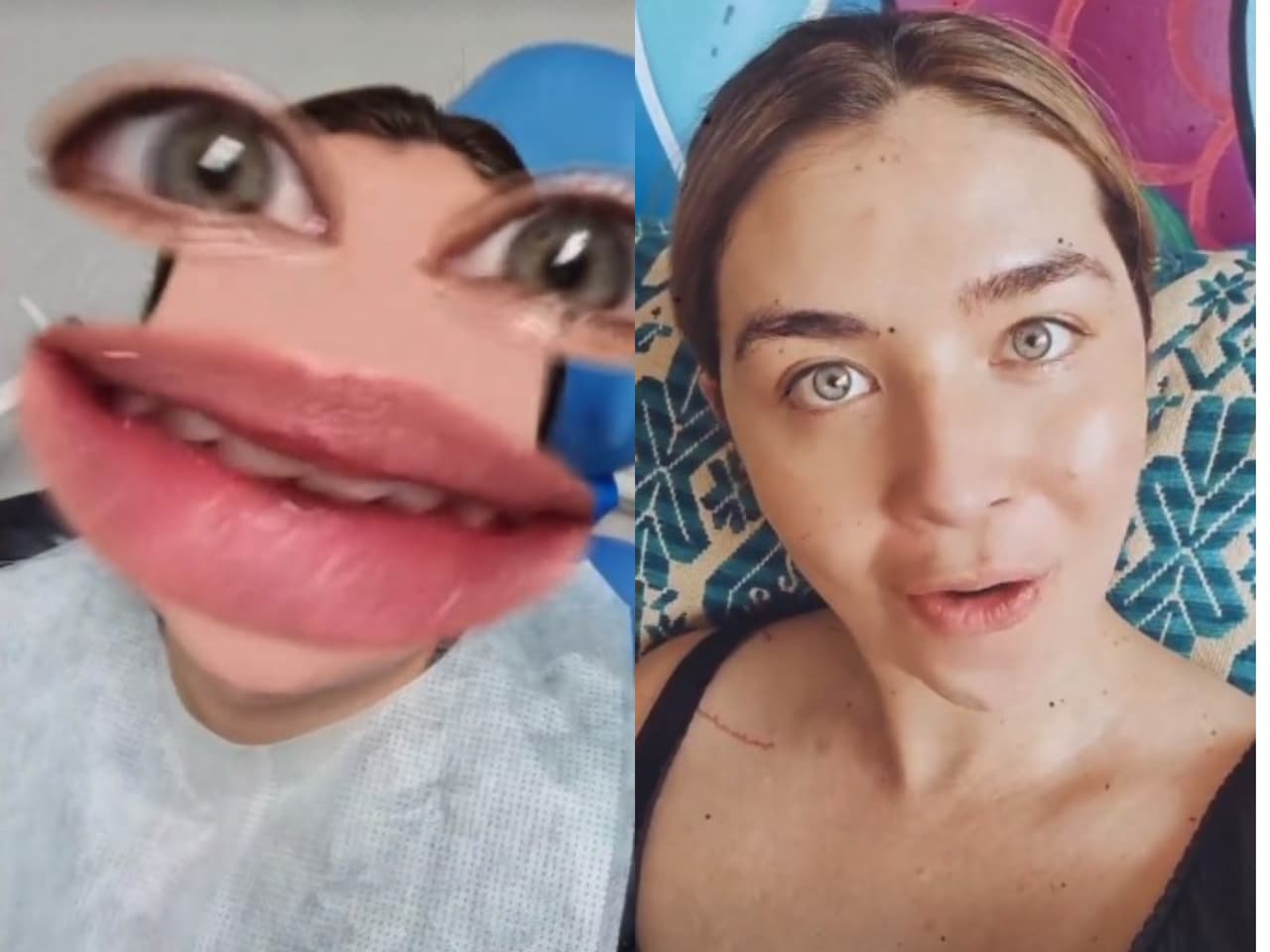 Daniela Luján reveló que tiene bruxismo y dio detalles de su salud